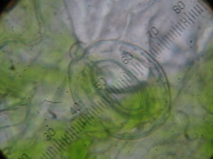 Stoma of a leaf under a light microscope